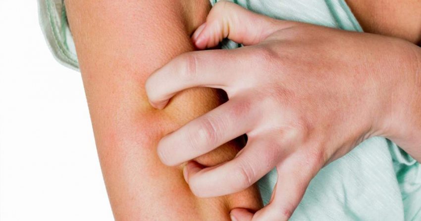 Kaşıntı nedir, neden oluşur?