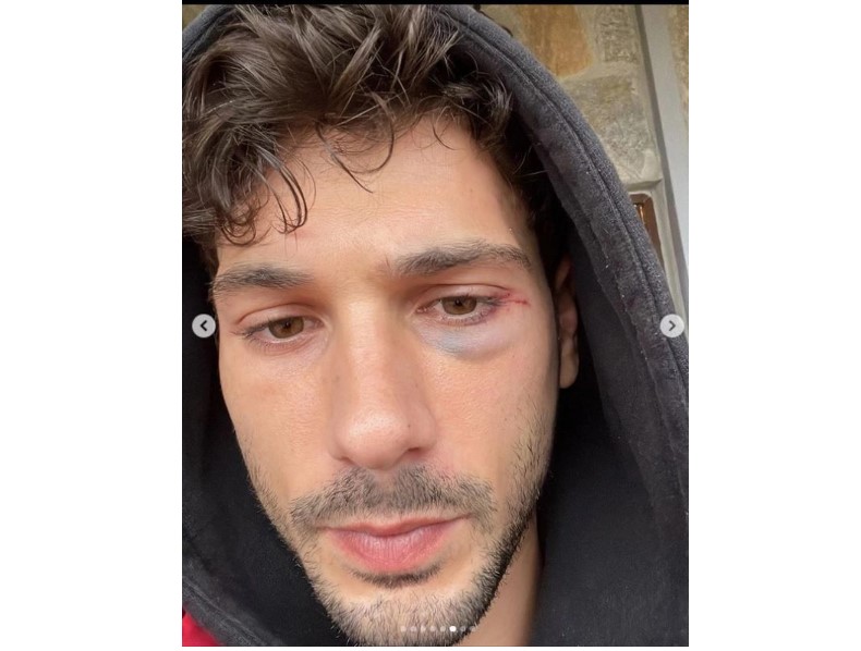 Kasaba Doktoru’nun Ömer’i Deniz Can Aktaş’tan şoke eden paylaşım, gözleri mosmor oldu!