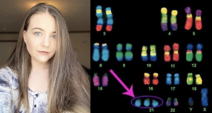 Down Sendromlu olduğumu 23 yaşında öğrendim”