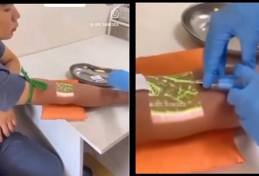 Çinliler bunu da yaptı! Damar yolu gösteren dijital bandaj…