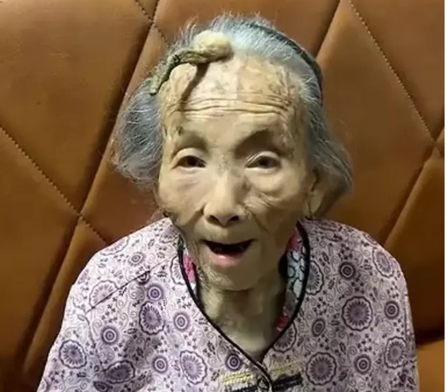 Yaşlı kadının kafasında boynuz çıktı! Kıyamet alameti mi?